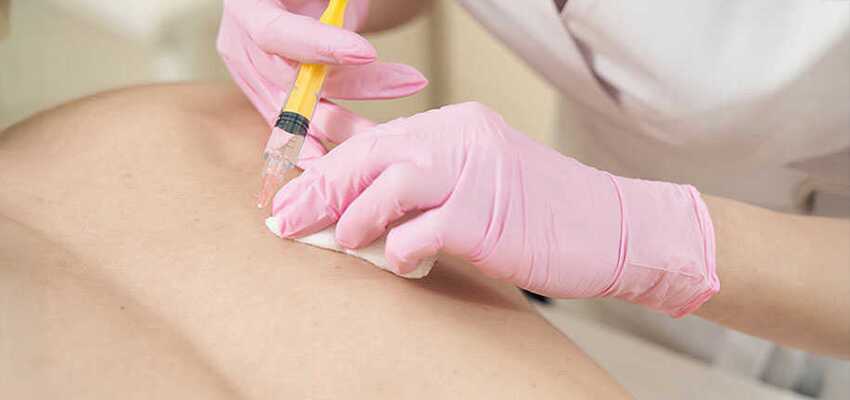Myofascial pain